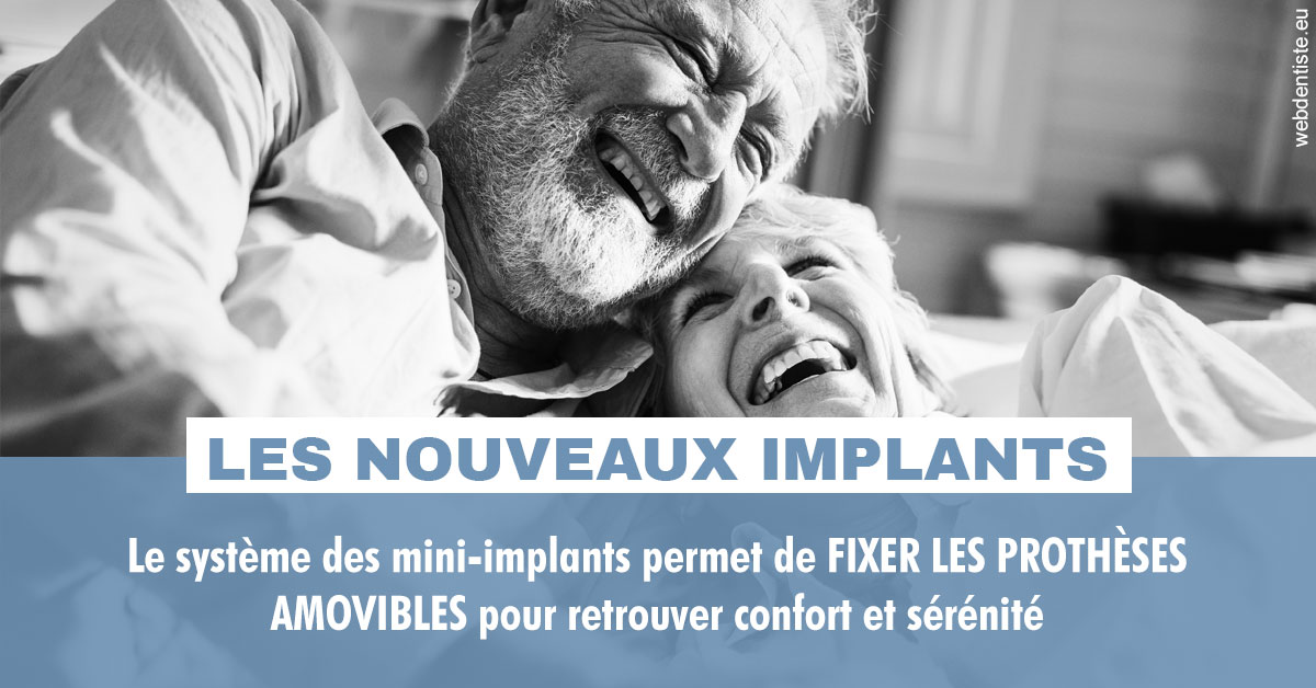 https://dr-dubois-jean-marc.chirurgiens-dentistes.fr/Les nouveaux implants 2