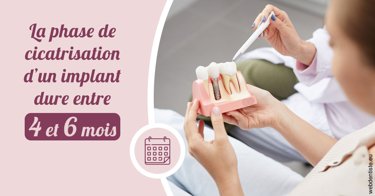 https://dr-dubois-jean-marc.chirurgiens-dentistes.fr/Cicatrisation implant 2