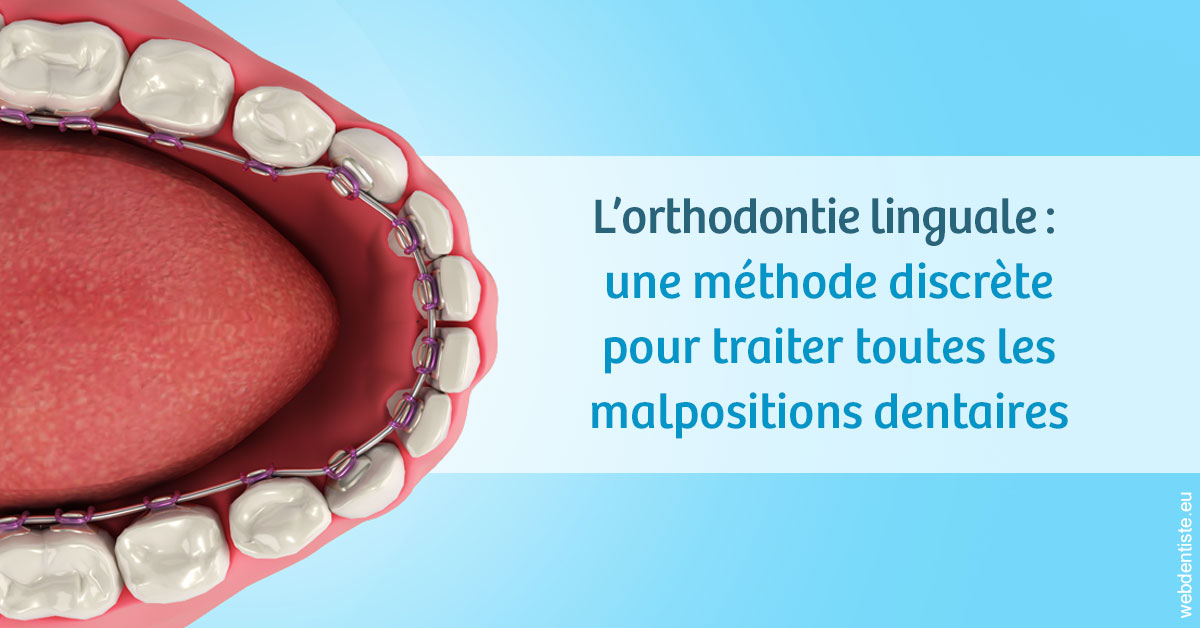 https://dr-dubois-jean-marc.chirurgiens-dentistes.fr/L'orthodontie linguale 1