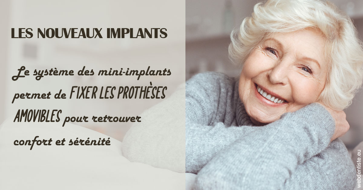 https://dr-dubois-jean-marc.chirurgiens-dentistes.fr/Les nouveaux implants 1