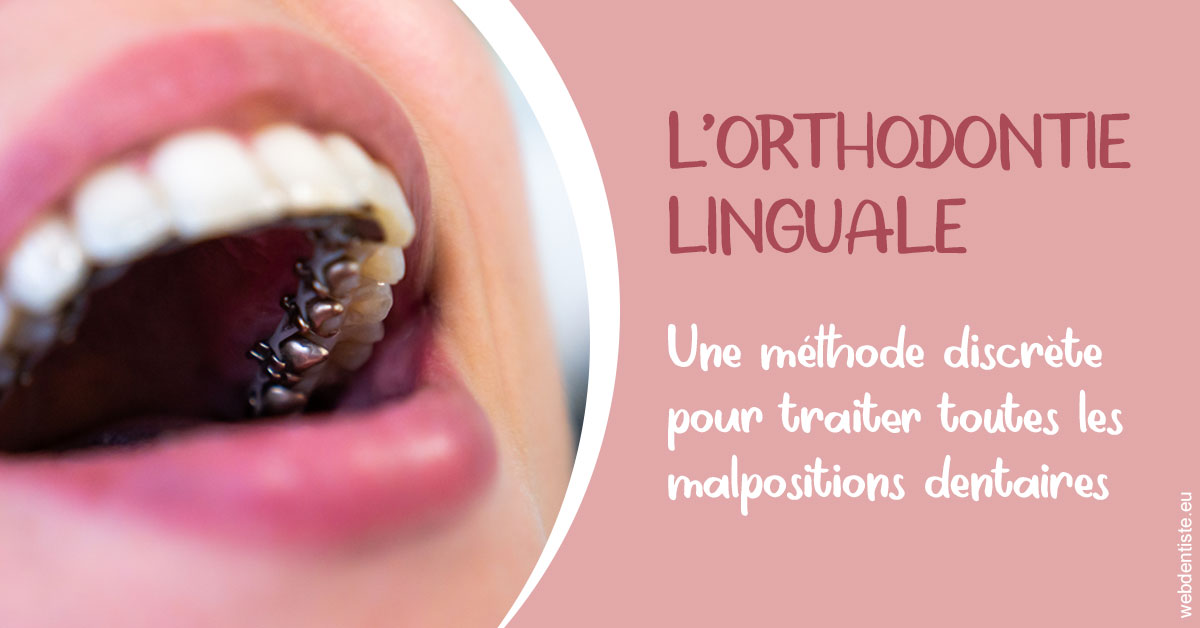 https://dr-dubois-jean-marc.chirurgiens-dentistes.fr/L'orthodontie linguale 2