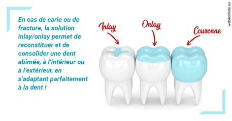 https://dr-dubois-jean-marc.chirurgiens-dentistes.fr/L'INLAY ou l'ONLAY