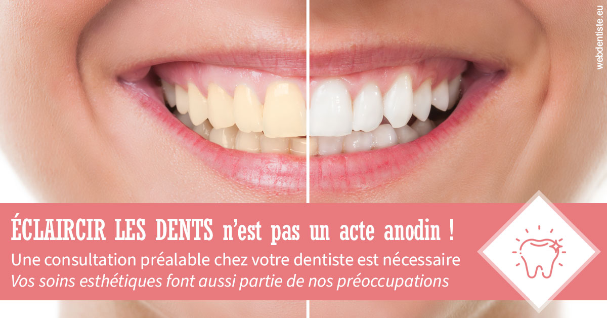 https://dr-dubois-jean-marc.chirurgiens-dentistes.fr/Eclaircir les dents 1