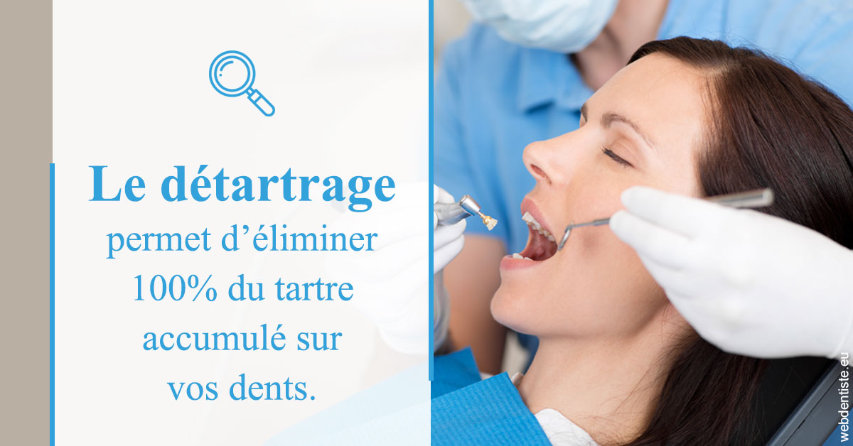https://dr-dubois-jean-marc.chirurgiens-dentistes.fr/En quoi consiste le détartrage