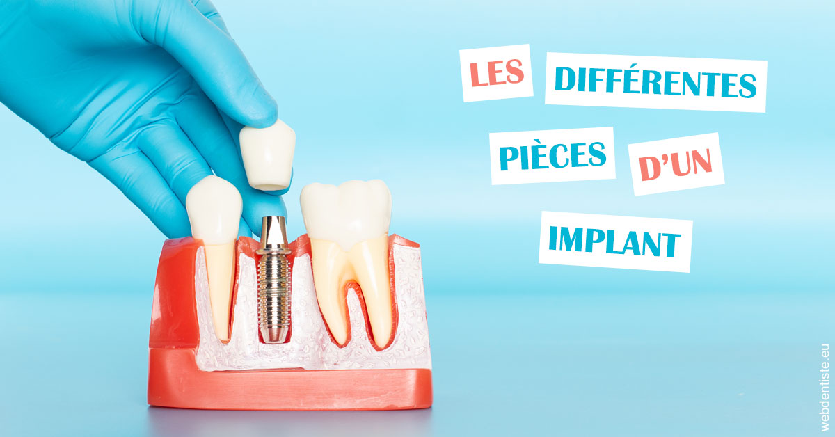 https://dr-dubois-jean-marc.chirurgiens-dentistes.fr/Les différentes pièces d’un implant 2