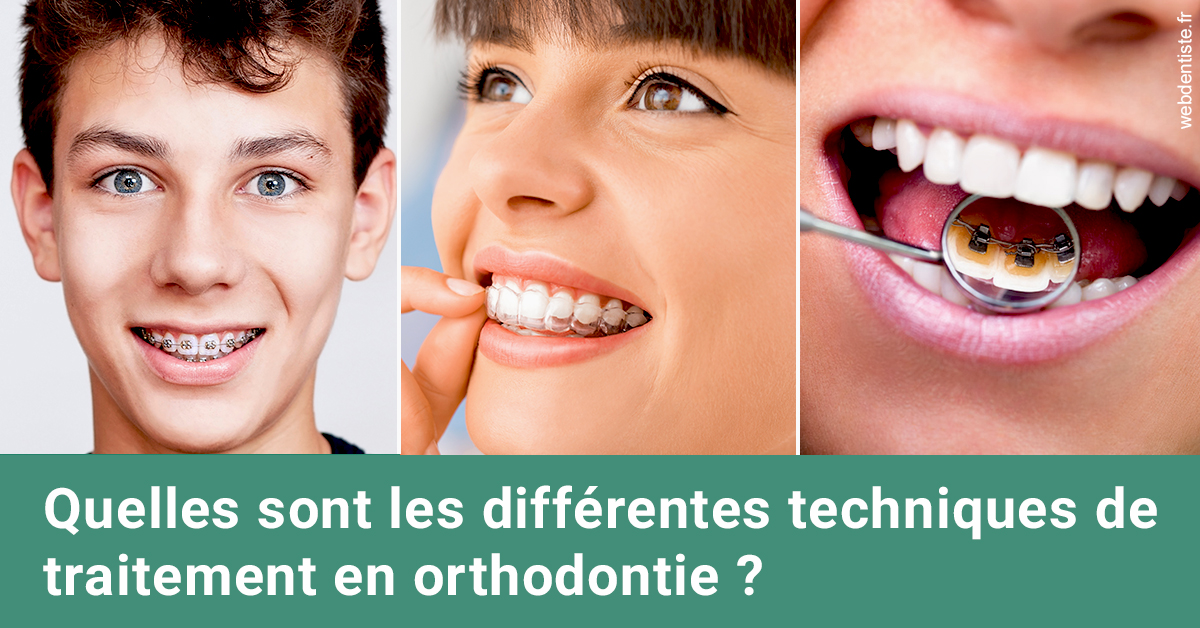 https://dr-dubois-jean-marc.chirurgiens-dentistes.fr/Les différentes techniques de traitement 2
