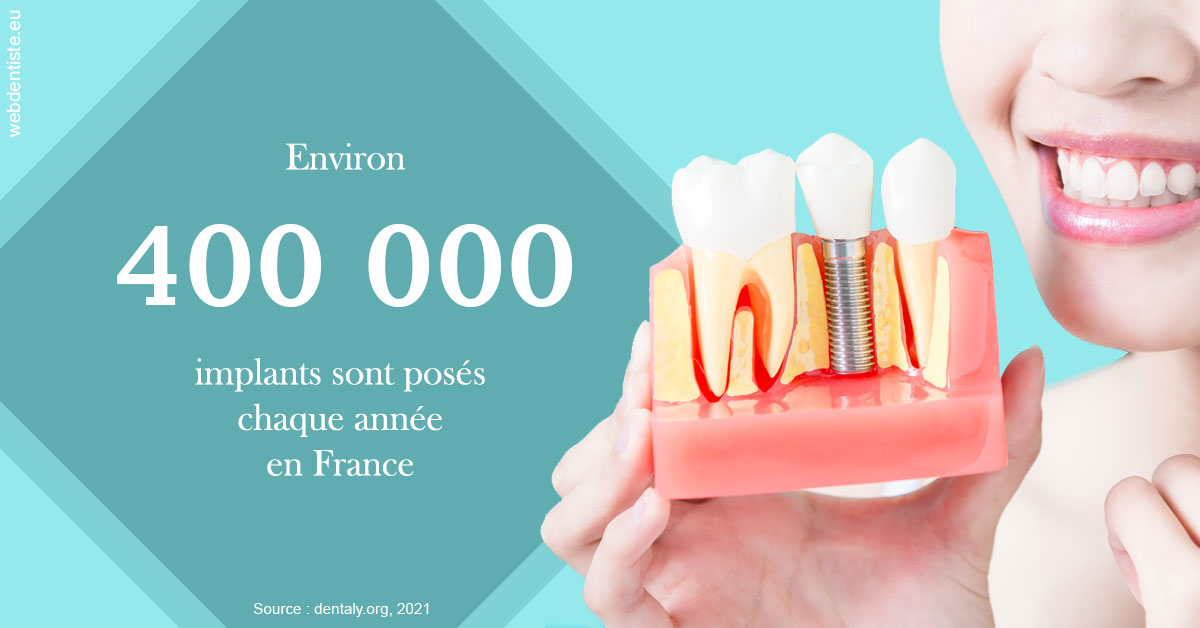 https://dr-dubois-jean-marc.chirurgiens-dentistes.fr/Pose d'implants en France 2